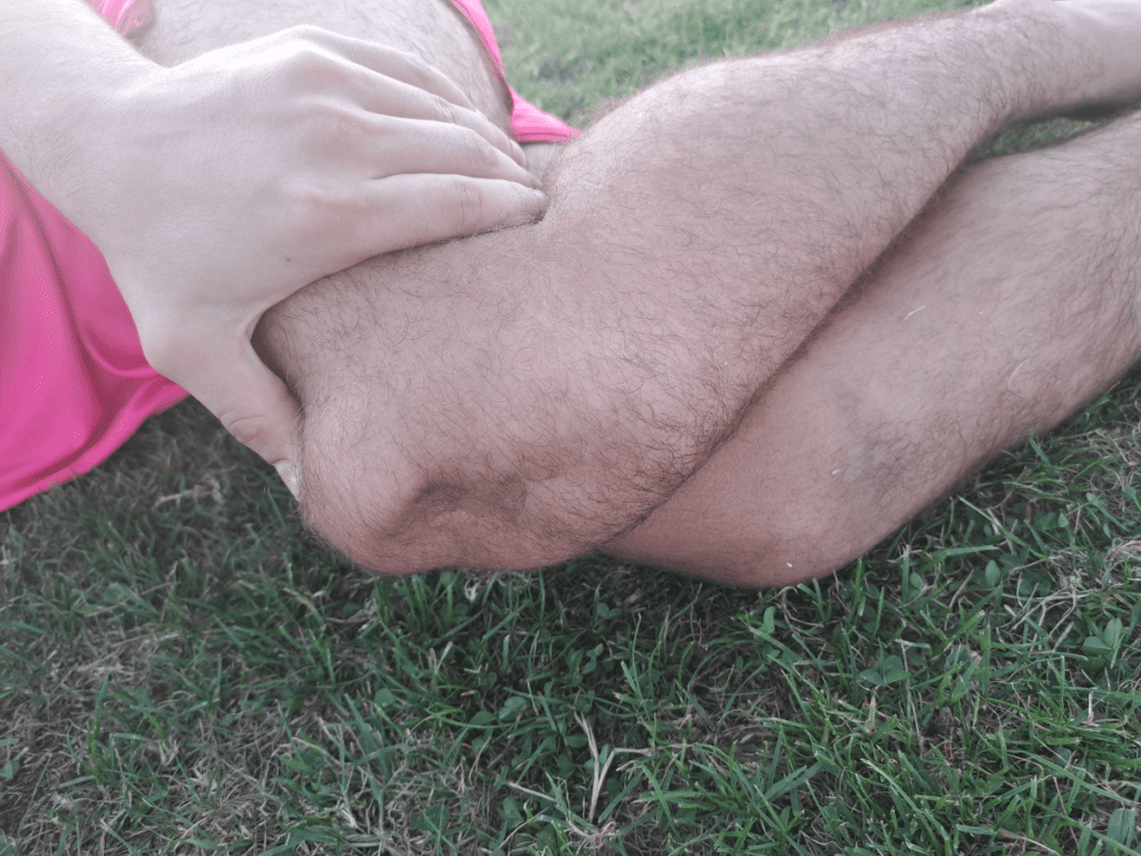 LUXATION OF THE PATELLA